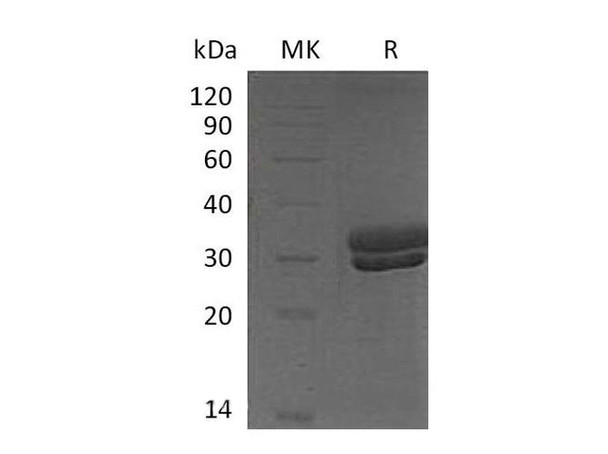 Mouse Kallikrein 7/KLK7 Recombinant Protein (RPES4873)