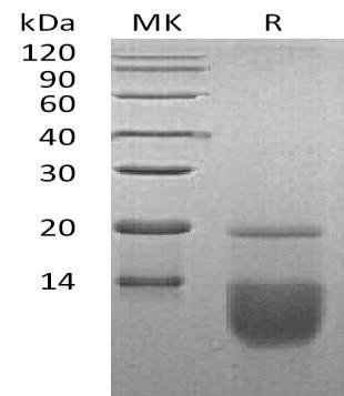 Human CCL3 Recombinant Protein (RPES4884)