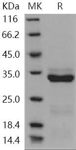 Human Trypsin-3/PRSS3 Recombinant Protein (RPES4916)