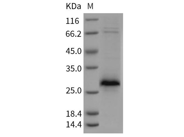 Rat XEDAR/EDA2R Recombinant Protein (His Tag) (RPES4928)