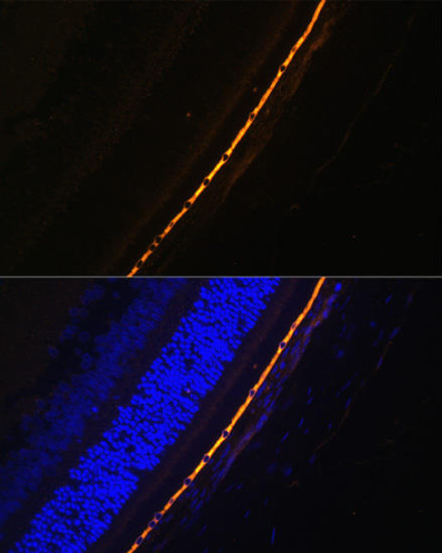 Anti-RPE65 Antibody (CAB9841)