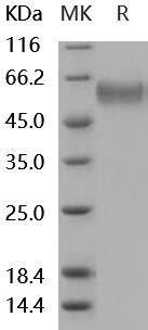 Mouse sFRP4 Recombinant Protein (His Tag) (RPES4983)