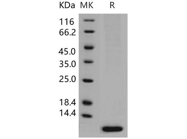 Human S100A6 Recombinant Protein (Baculovirus, His Tag) (RPES5000)