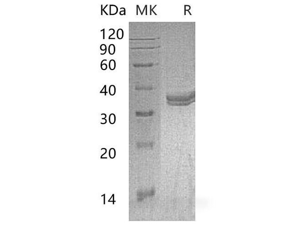 Mouse CA4 Recombinant Protein (RPES5011)