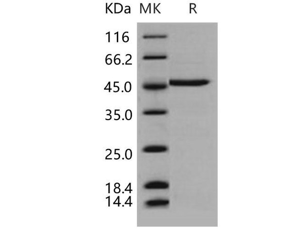 Human DDOST/OST48 Recombinant Protein (RPES5024)