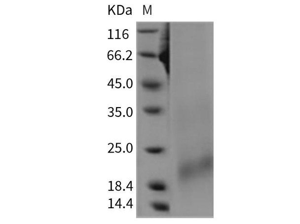 Rat BAFFR/TNFRSF13C Recombinant Protein (His Tag) (RPES5049)