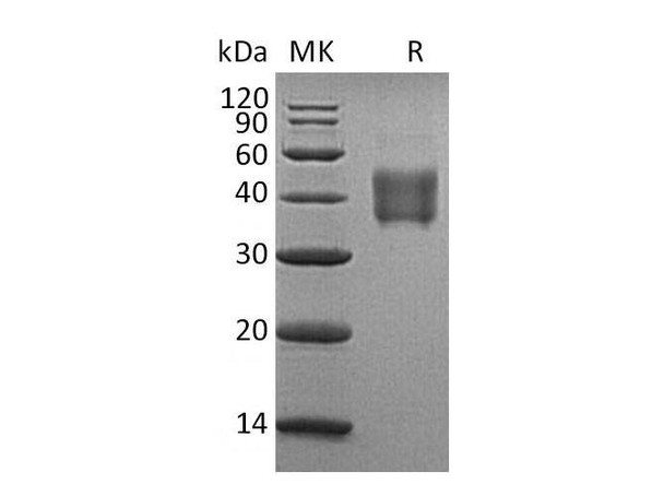 Human SLAMF5/CD84 Recombinant Protein (RPES5069)