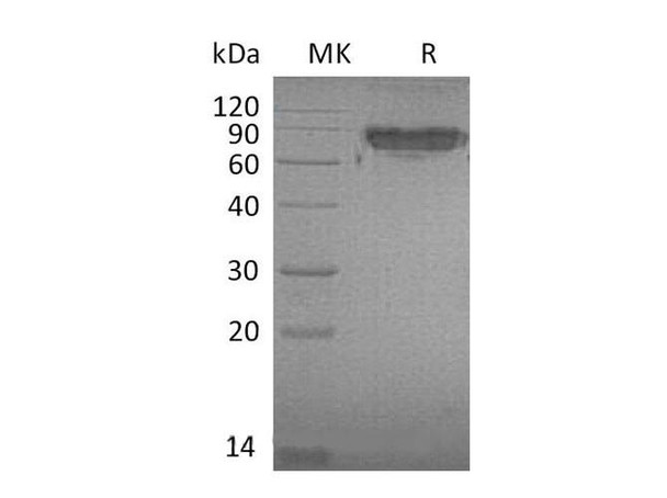 Mouse ICAM-2/CD102 Recombinant Protein (RPES5074)