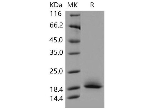 Mouse CD59a/MAC-IP Recombinant Protein (His Tag) (RPES5081)