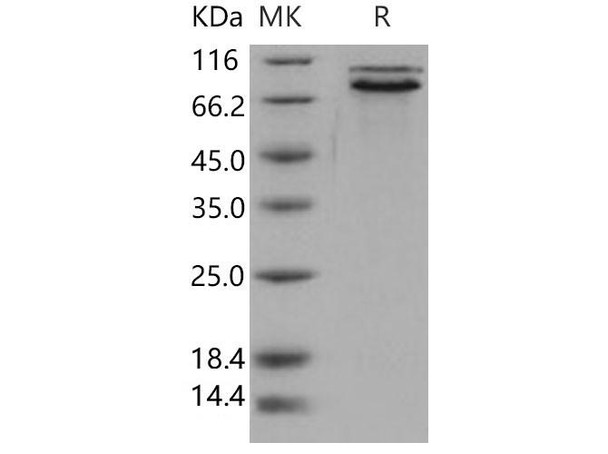 Human E-Cadherin/CDH1 Recombinant Protein (RPES5103)