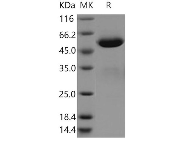 Human BTN3A3 Recombinant Protein (Fc Tag) (RPES5115)