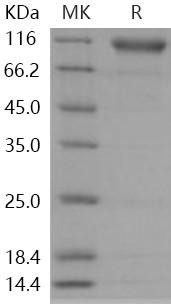 Human Semaphorin 4D/SEMA4D Recombinant Protein (His Tag) (Active) (RPES5116)