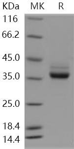 Human CSAGE/CSAG1 Recombinant Protein (Fc Tag) (RPES5136)