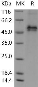 Mouse Follistatin/FST Recombinant Protein (His Tag) (Active) (RPES5140)