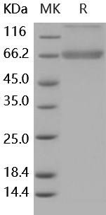 Human Decorin/DCN Recombinant Protein (RPES5162)