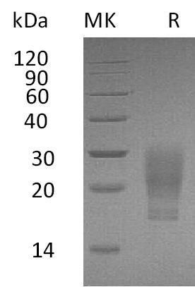 Human GM-CSF/CSF2 Recombinant Protein (RPES5164)
