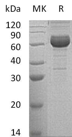 Human NCR1 Recombinant Protein (RPES5184)