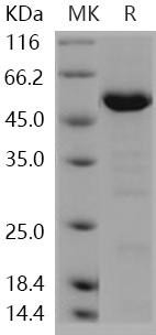 Human HDAC4 Recombinant Protein (aa 612084) (RPES5195)