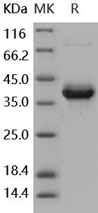 Human S100A4 Recombinant Protein (Fc Tag) (RPES5201)