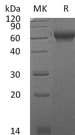 Mouse CHL2/CHRDL2 Recombinant Protein (RPES5228)