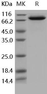 Human IL18RAP/IL1R7 Recombinant Protein (RPES5244)