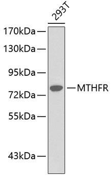 MTHFR Rabbit Polyclonal Antibody (CAB0305)
