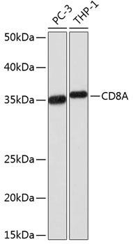 CD8A Rabbit Monoclonal Antibody (CAB0663)
