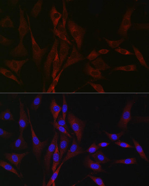 CACNA1H Polyclonal Antibody (CAB10697)