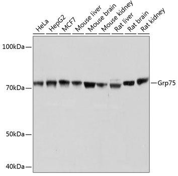 Grp75/MOT/HSPA9 Rabbit Monoclonal Antibody (CAB11256)