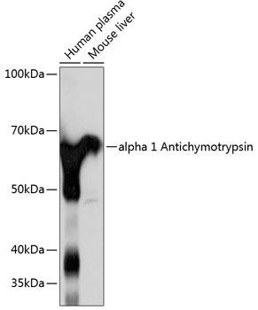 Alpha-1 Antichymotrypsin (SERPINA3) Rabbit Monoclonal Antibody (CAB11364)