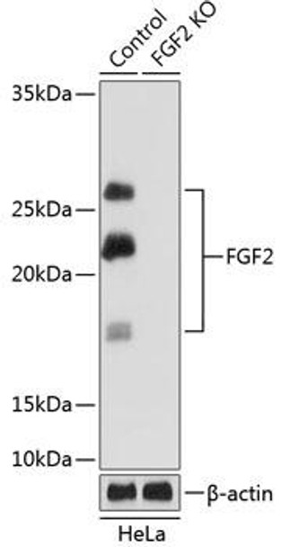 [KO Validated] FGF2 Rabbit Monoclonal Antibody (CAB11488)