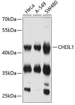 CHI3L1 Rabbit Polyclonal Antibody (CAB11510)