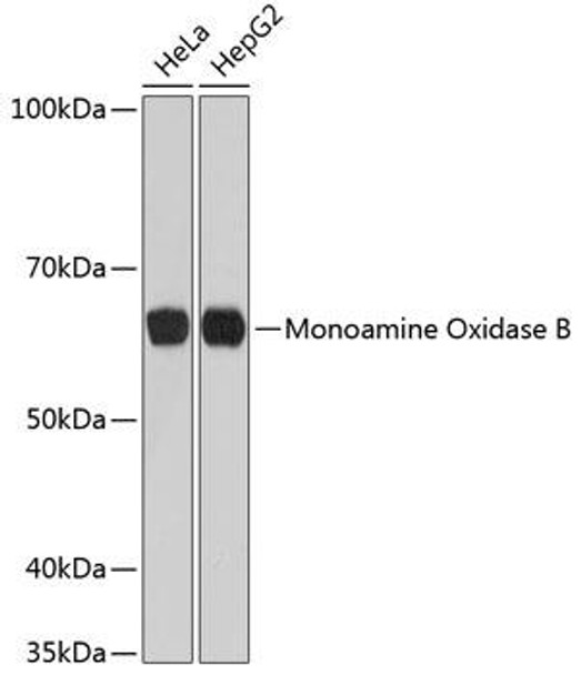 Monoamine Oxidase B (MAOB) Rabbit Monoclonal Antibody (CAB11597)