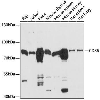 CD86 Rabbit Polyclonal Antibody (CAB16805)