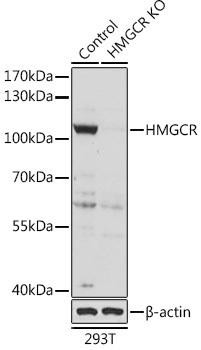 [KO Validated] HMGCR Rabbit Polyclonal Antibody (CAB16876)