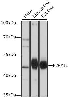 P2RY11 Rabbit Polyclonal Antibody (CAB16940)