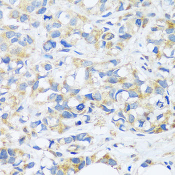 BRK1 Rabbit Polyclonal Antibody (CAB17182)