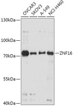ZNF16 Rabbit Polyclonal Antibody (CAB17548)