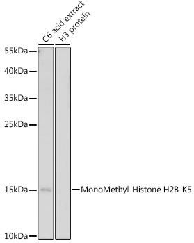 MonoMethyl-Histone H2B-K5 Rabbit Polyclonal Antibody (CAB17552)