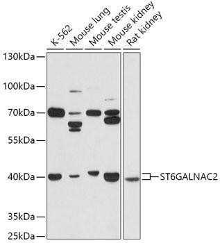 ST6GALNAC2 Rabbit Polyclonal Antibody (CAB17618)