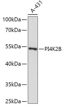 PI4K2B Rabbit Polyclonal Antibody (CAB17719)
