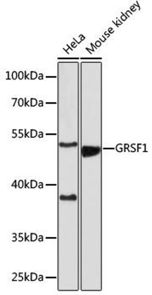 Anti-GRSF1 Antibody (CAB18227)