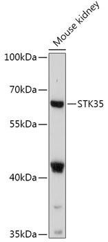 STK35 Rabbit Polyclonal Antibody (CAB17828)