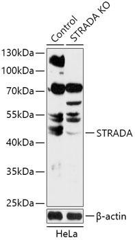 [KO Validated] STRADA Rabbit Polyclonal Antibody (CAB18012)
