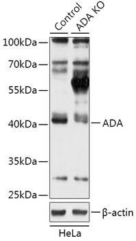[KO Validated] Adenosine Deaminase (ADA) Rabbit Polyclonal Antibody (CAB18029)
