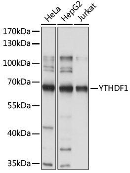 YTHDF1 Rabbit Polyclonal Antibody (CAB18126)