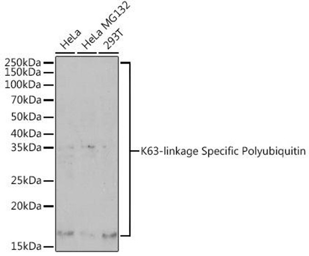 K63-linkage Specific Polyubiquitin Rabbit Polyclonal Antibody (CAB18164)