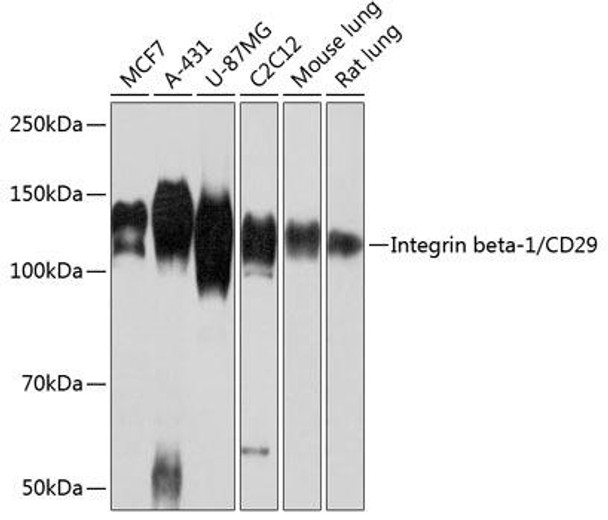 Anti-Integrin beta-1/CD29 Antibody (CAB19072)