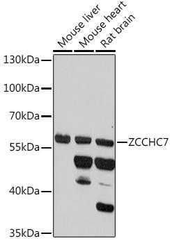 ZCCHC7 Rabbit Polyclonal Antibody (CAB18251)