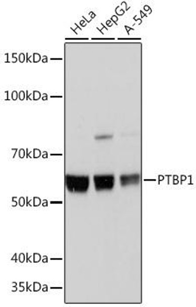 Anti-PTBP1 Antibody (CAB3487)